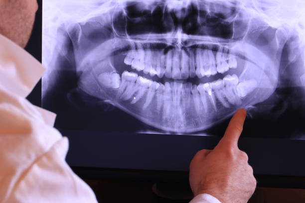 Reliable WY Emergency Dentist Solutions