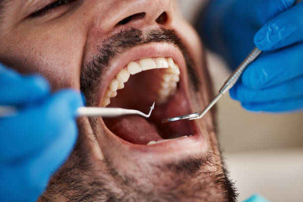 Best Emergency Dental Care for Broken or Chipped Teeth in Wright, WY